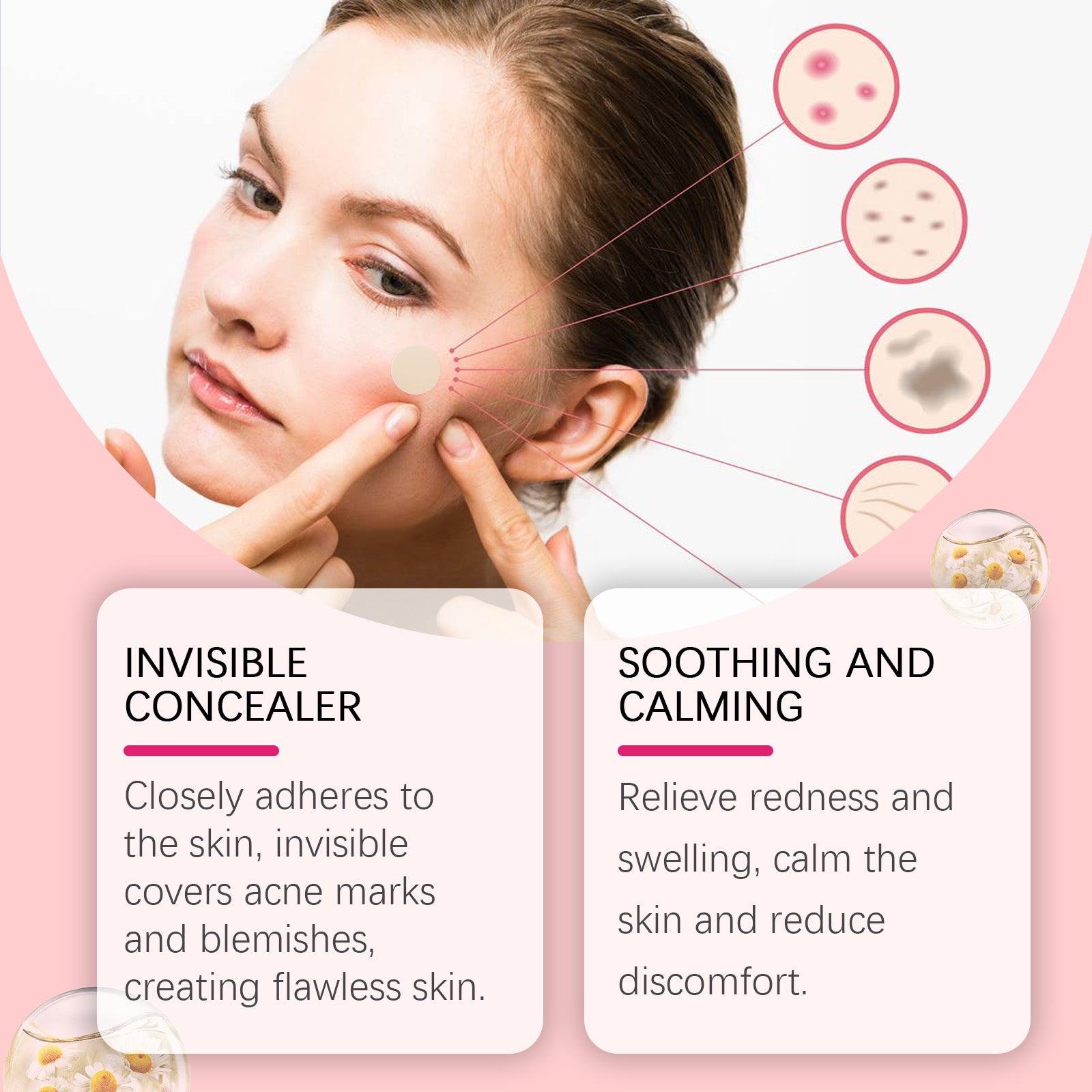 Repair Acne Patch, Facial Cleansing Cover Acne Skin Moisturizing Gentle Skin Cream - Korvel