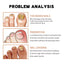 Nail Care Relief Oil for Healthy, Bright Nails