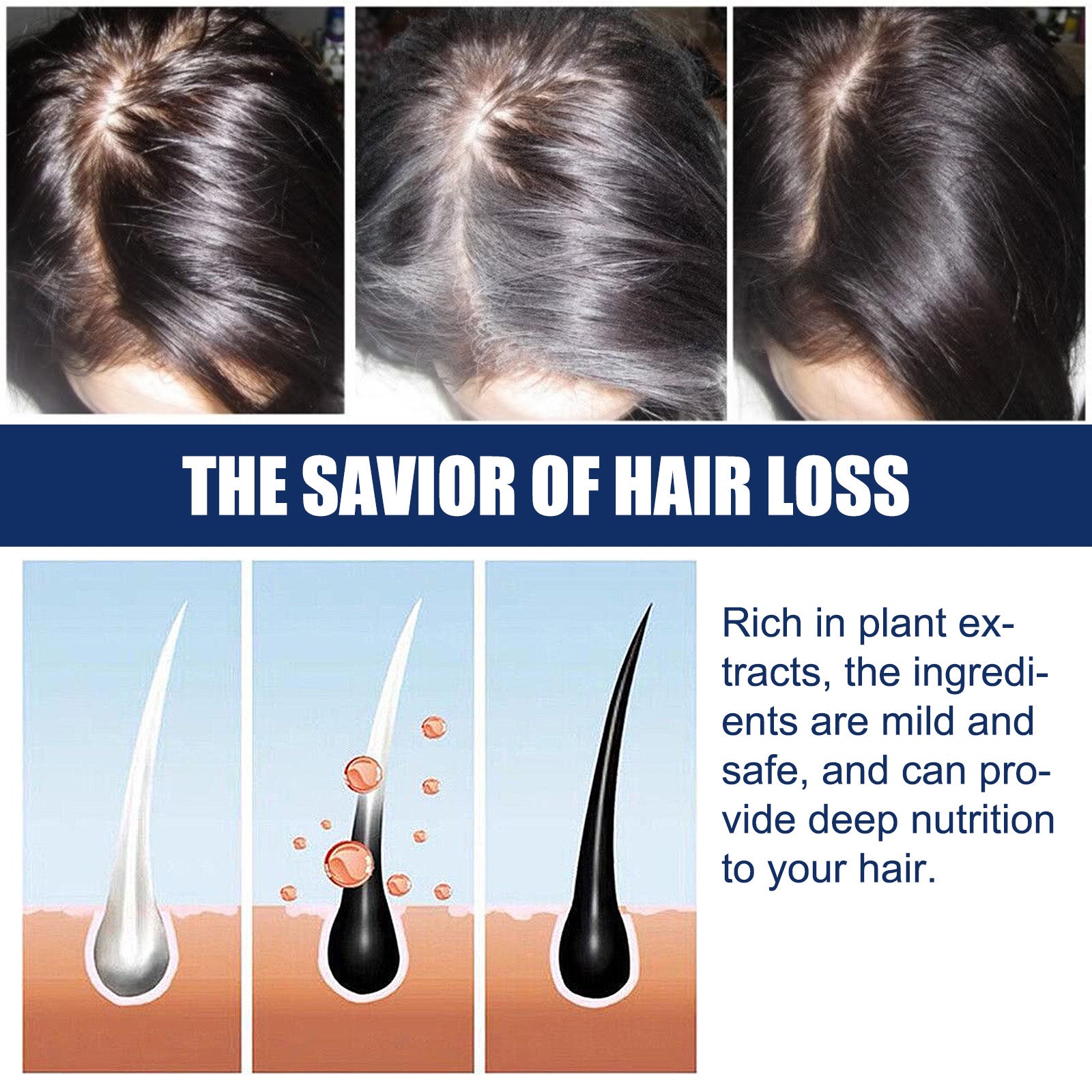 Alopecias Hair Growth Cream, Protect Hair Follicles Strong Moisturizing Thick Hairline Hair - Korvel