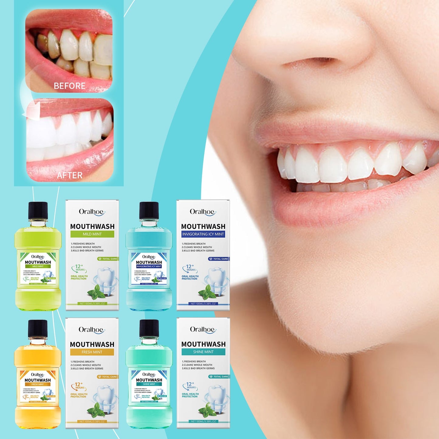 Breath Freshening Mouthwash Fresh Breath Daily Care Teeth Cleaning Odor Mouthwash - Korvel