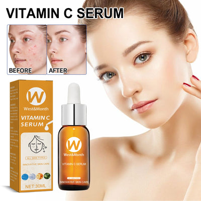 Facial Treatment Essence, Lighten Facial Acne Mark Oil Control Firming Skin Essence - Korvel