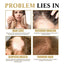 Ginseng Massage Essence, Moisturizes Scalp Strengthens Hair Prevents Loss Hair Care Essence - Korvel