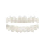 Braces de dentier premium pour un sourire confiant