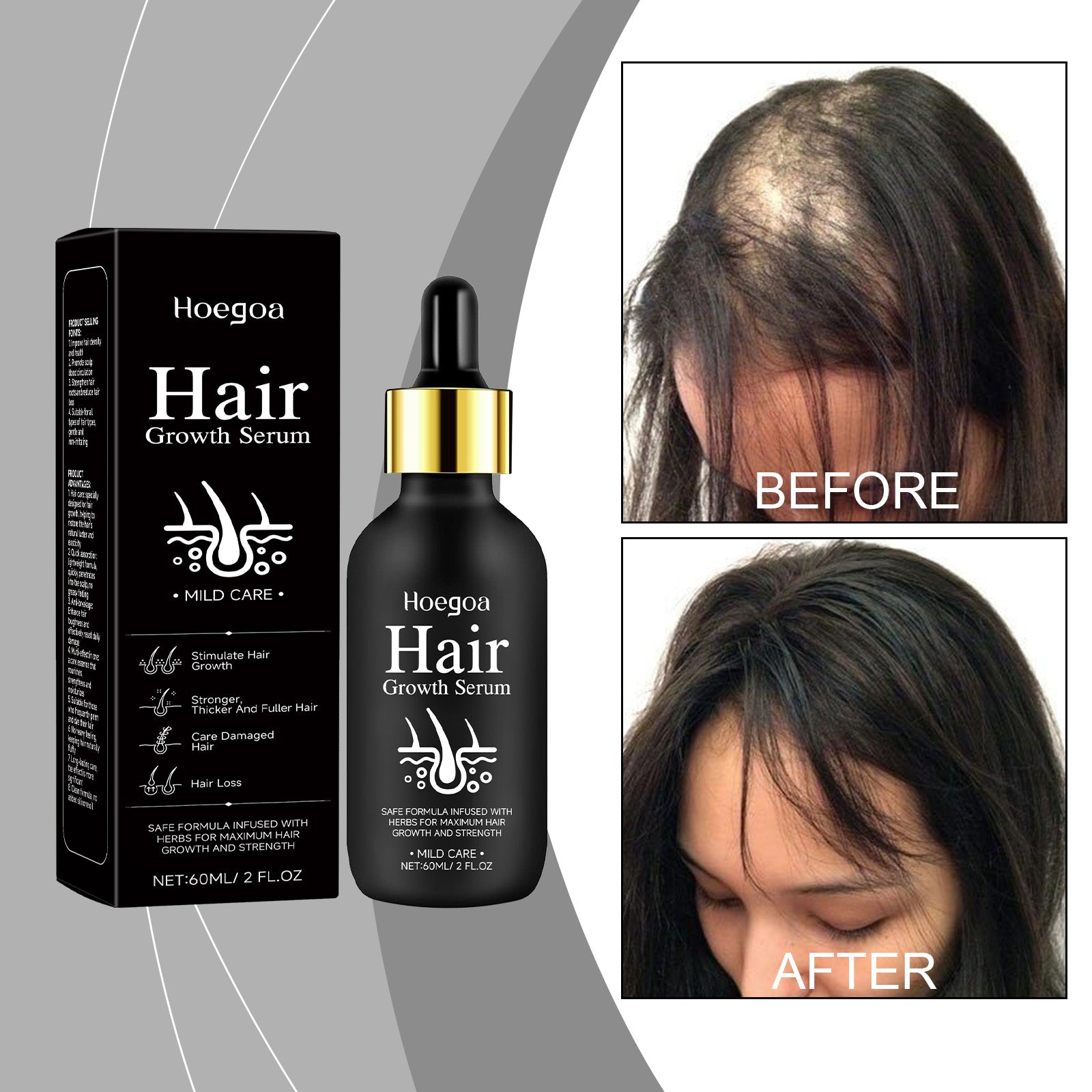Hair Care Serum, Strengthens Hair And Nourishes Scalp Care Daily Massage Treatment Serum - Korvel