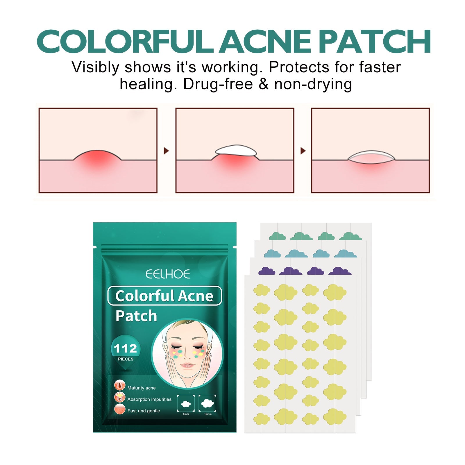 Colorful Acne Patch, Repair Pit Acne Print Smooth Skin Lightening Spot Clear Acne Facial - Korvel