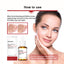 Mandelic Acid Daily Update Essence, Acne-Removing And Acne-Closing Repair Brightening Fruit Acid Essence - Korvel