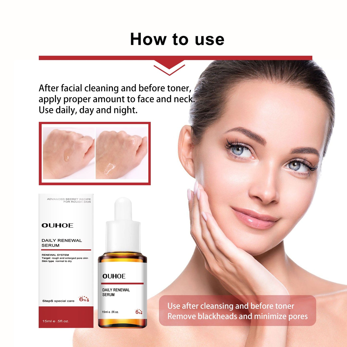 Mandelic Acid Daily Update Essence, Acne-Removing And Acne-Closing Repair Brightening Fruit Acid Essence - Korvel