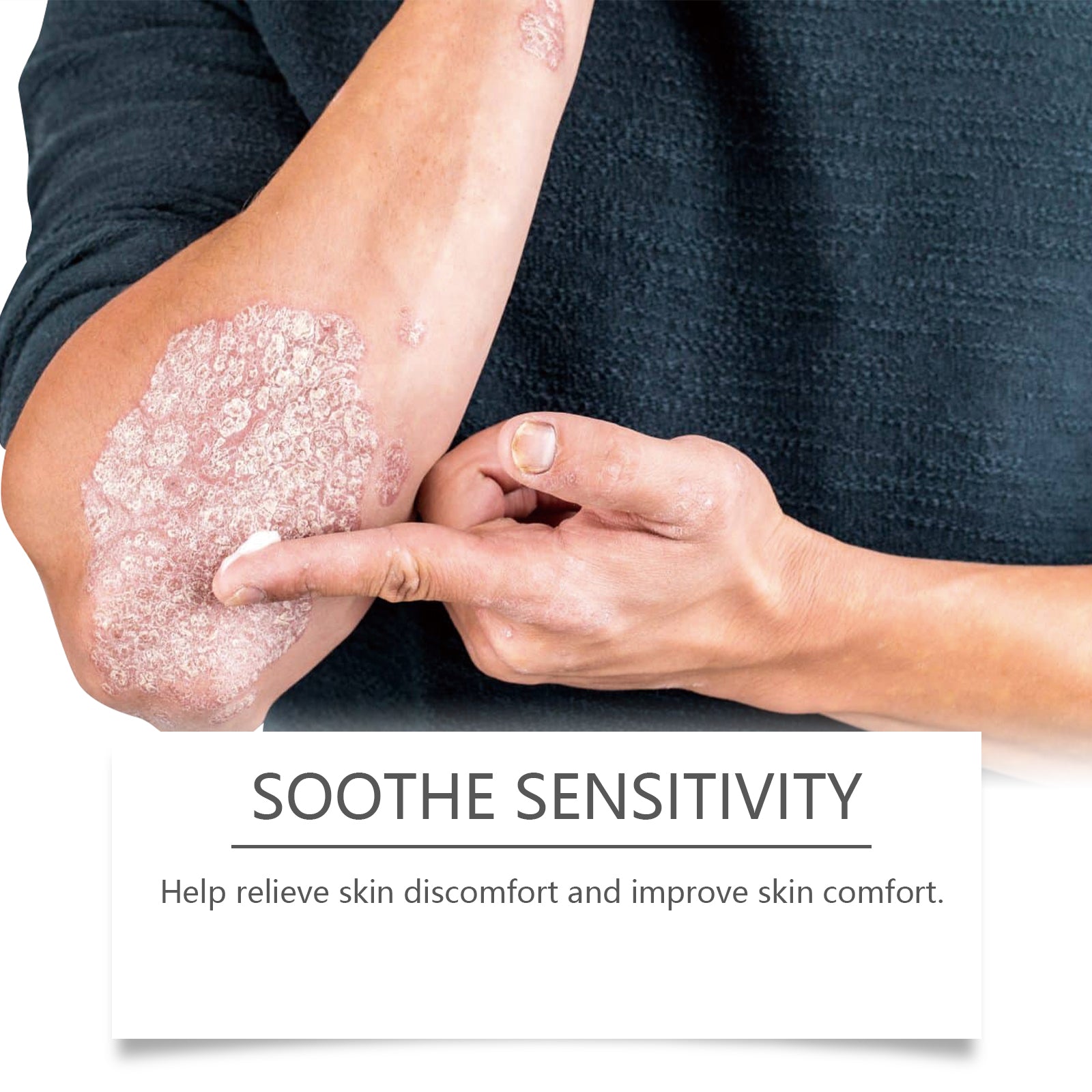 Shea Butter Moisturizer, Soothing Skin Discomforter Redness Moisturizing Refreshing Daily Maintenance Topical Cream - Korvel