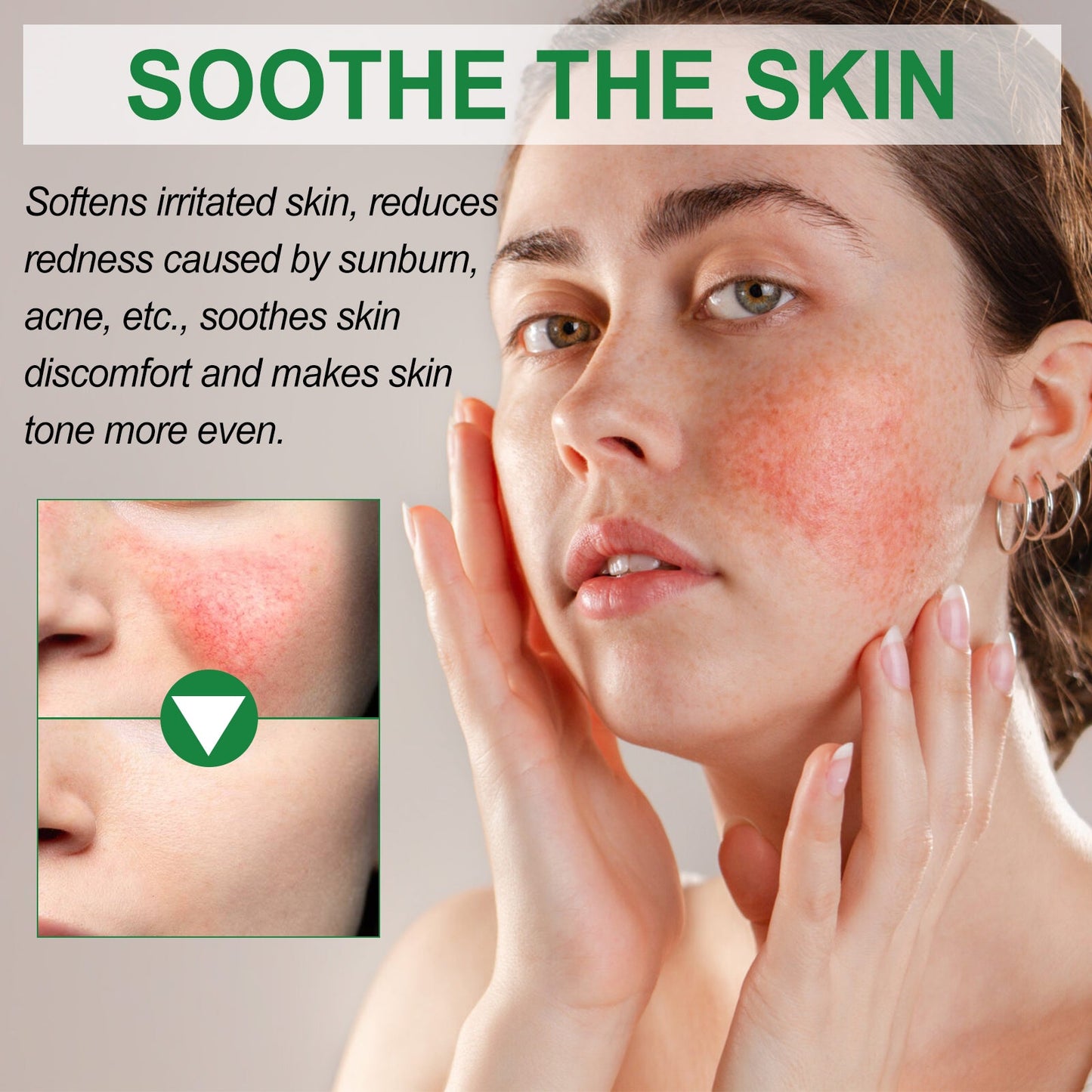 Color Correction Treatment Cream, Lighten Spots After Sun Repair Moisturizing Skin Beauty Cream - Korvel