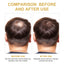 Hair Dense Oil, Scalp Cleaning Care Fluffy Soft Repair Dry Hair Impetuous Solid Hair Dense Hair Essential Oil - Korvel