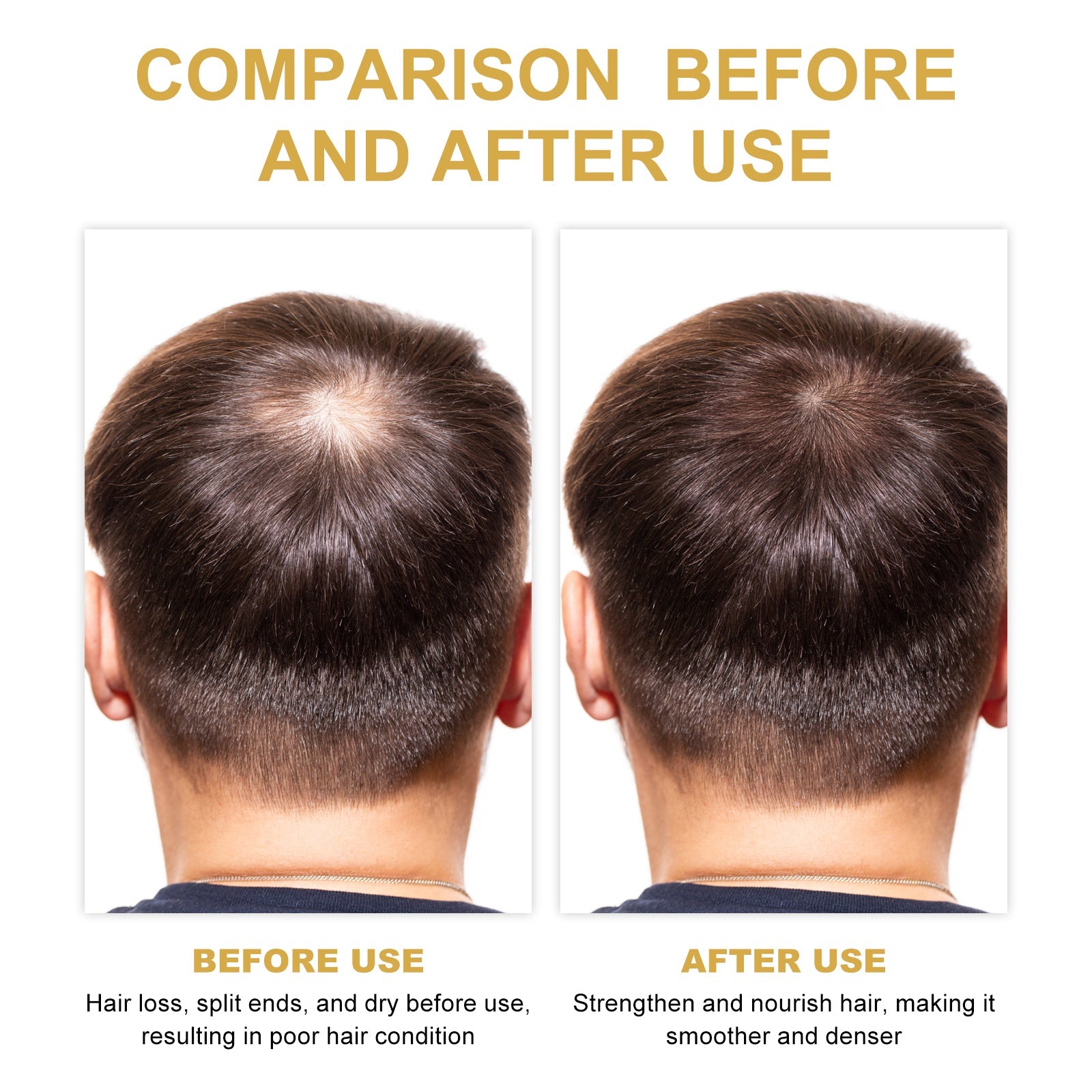 Hair Dense Oil, Scalp Cleaning Care Fluffy Soft Repair Dry Hair Impetuous Solid Hair Dense Hair Essential Oil - Korvel