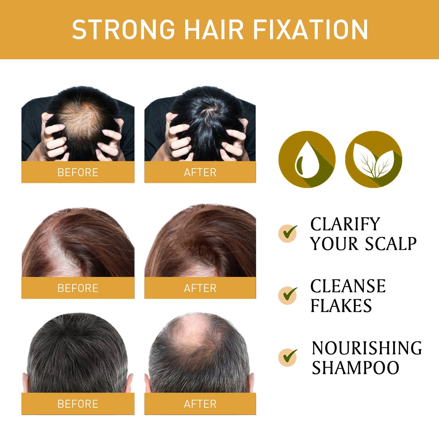 Shampoo Bar, Solid Hair Tight Hair Anti-Loss Soft Repair Hair End Dry Damaged Shampoo Soap - Korvel