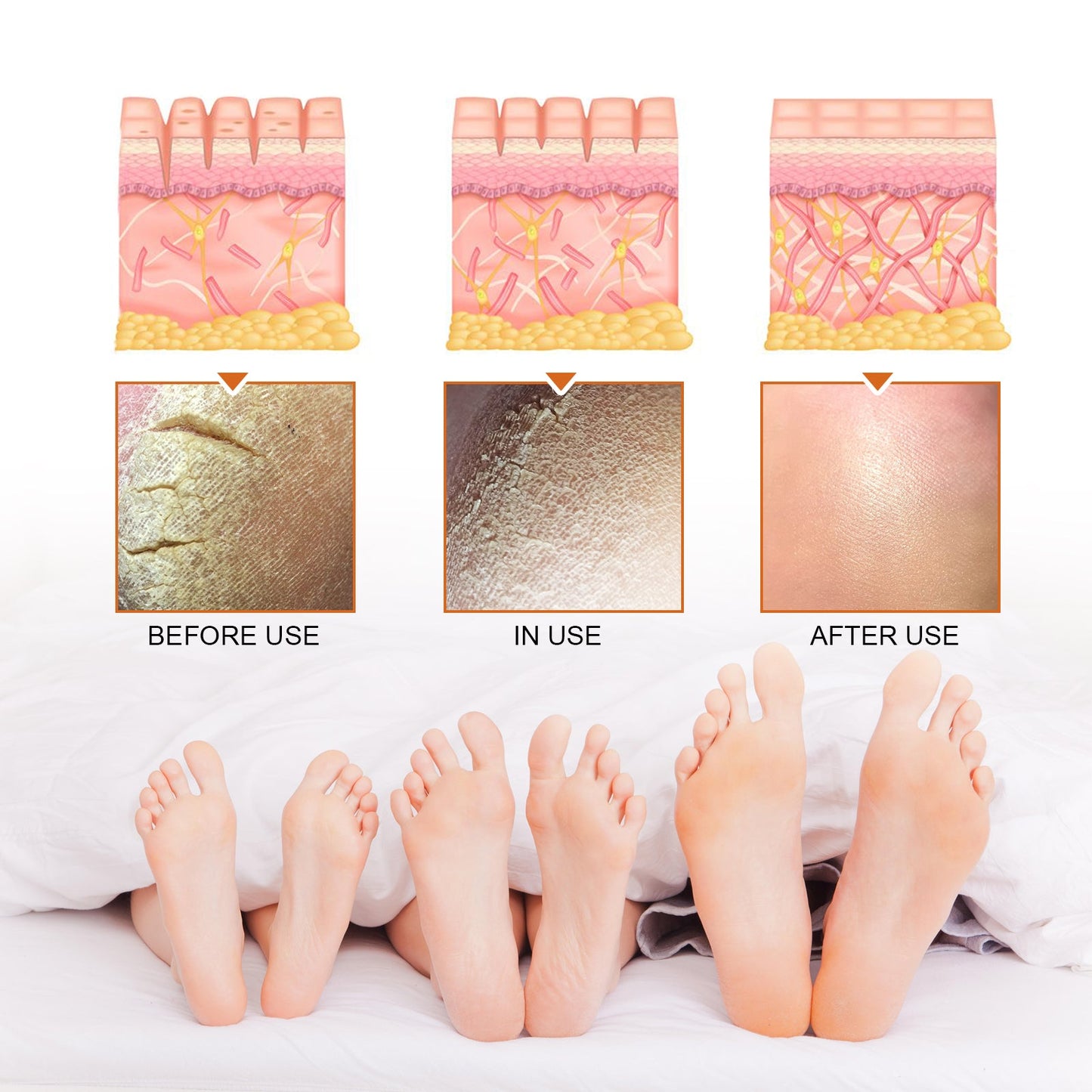 Exfoliating Treatment Spray Deep Clean Exfoliating Dead Skin Whitening And Tender Skin Spray - Korvel