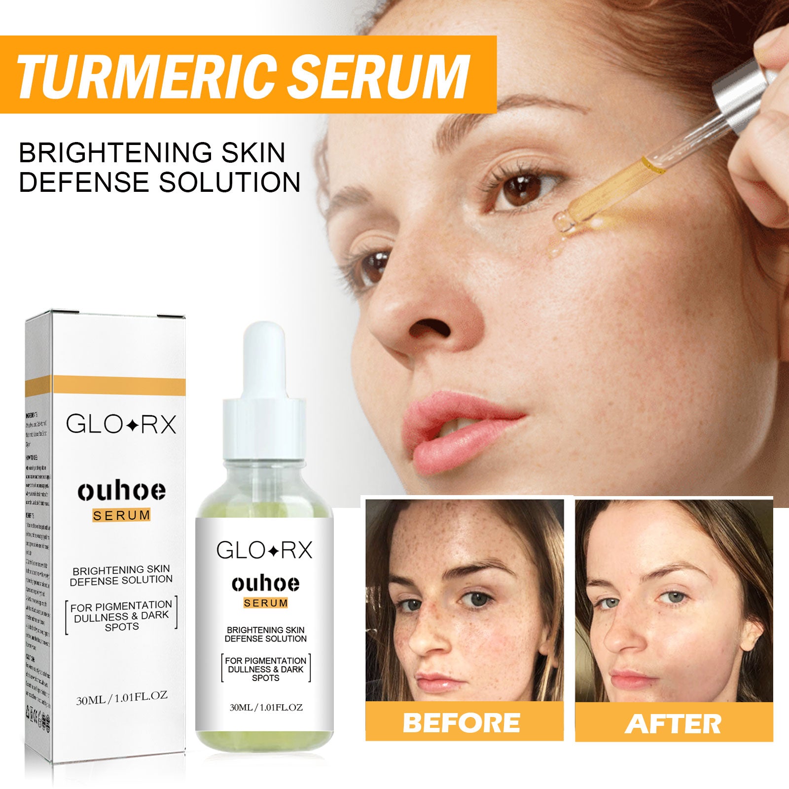 Turmeric Whitening Spot Serum, Lighten Freckle Spots Brightening Skin Hydrating Serum - Korvel
