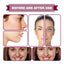 Acid Essence, Shrinks Pores, Removes Blackheads, Pimples And Acne Marks, Brightens Skin Tone Moisturizing Essence - Korvel