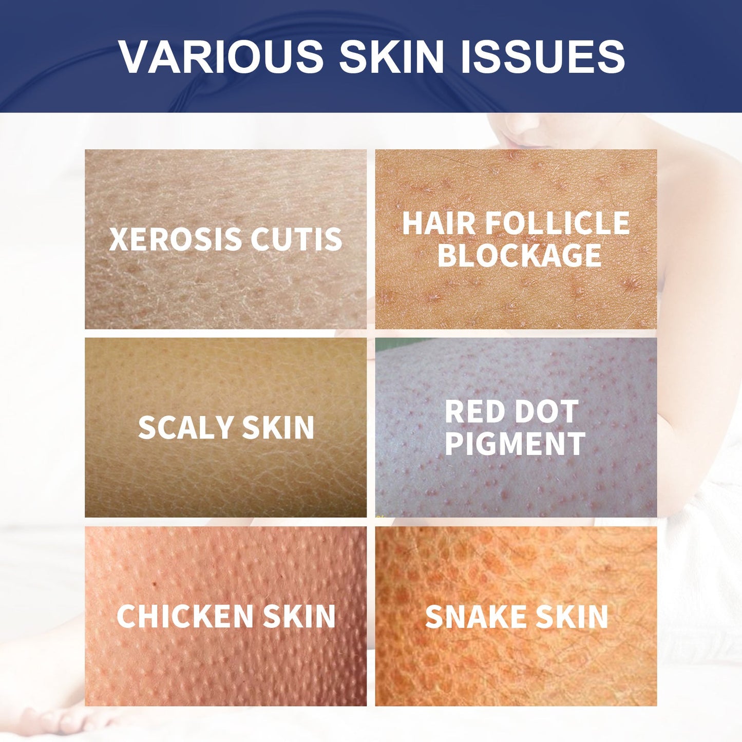 Body Whitening Scrub, Deep Body Cleansing Treatment Gently Exfoliates Dead Skin Whitening Skin - Korvel