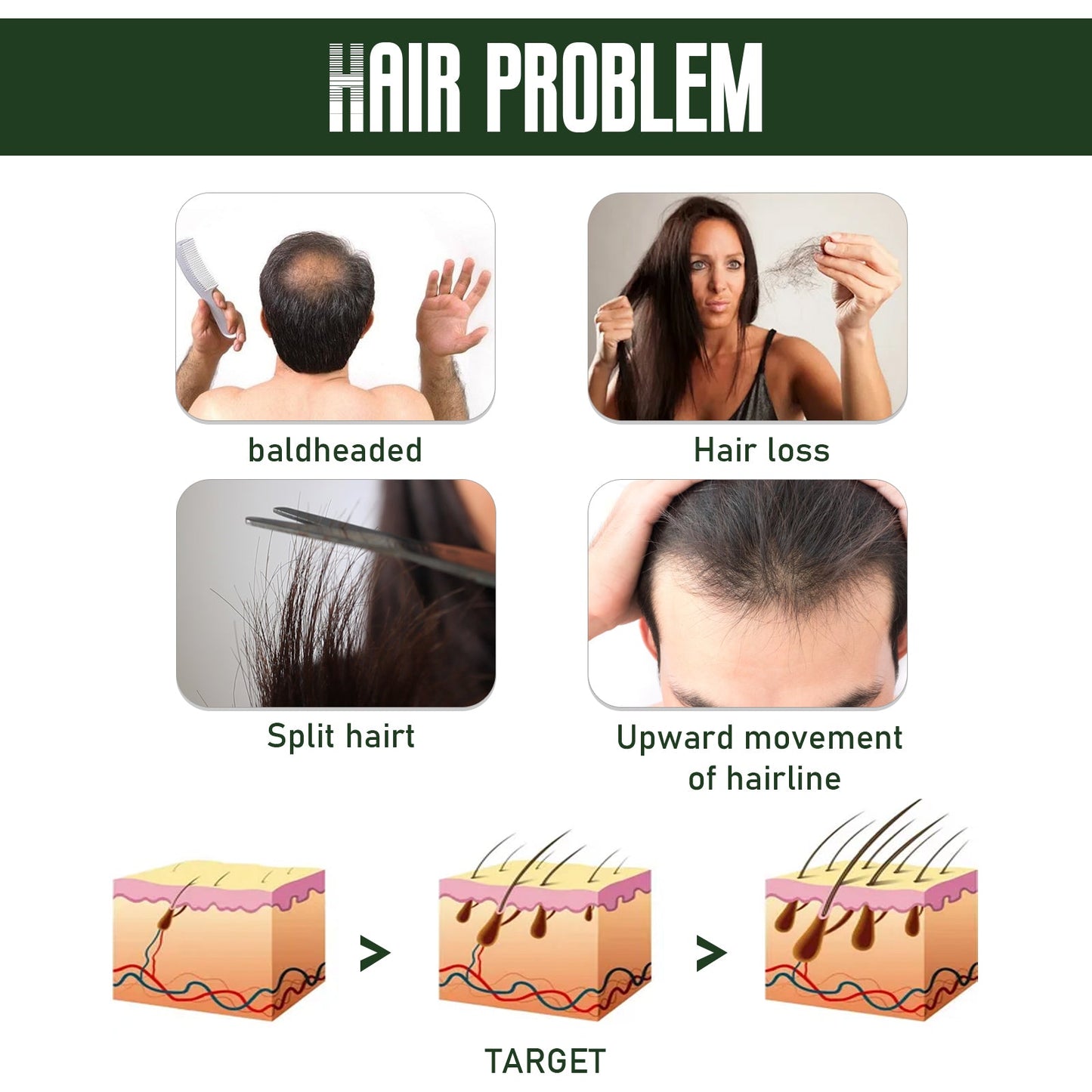 Ginger Dense Hair Spray for Nourishing and Moisturizing Hair