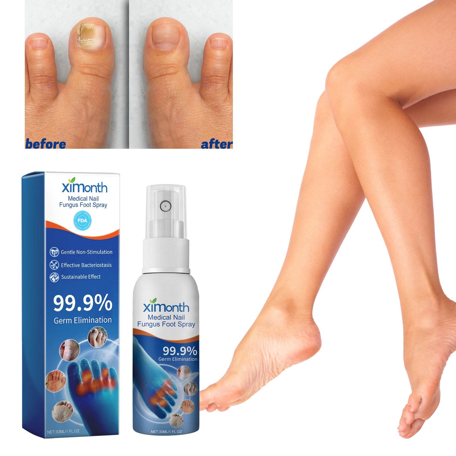 Medical Nail Fungus Foot Spray, Repair Thickening Gray Nail Rot Foot Moisturizing And Cleansing Armor - Korvel