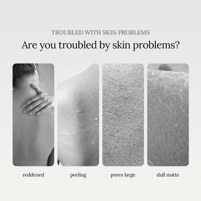 Niacinamide Scented Shower Gel, Body Cleans Corneous Brighten Skin Tone Delicate Pore Moisturize Repair - Korvel