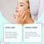 Azelaic Acid Acne Cream, Oil Control Gentle Moisturizing Acne Skin Moisturizing Daily Facial Cream - Korvel