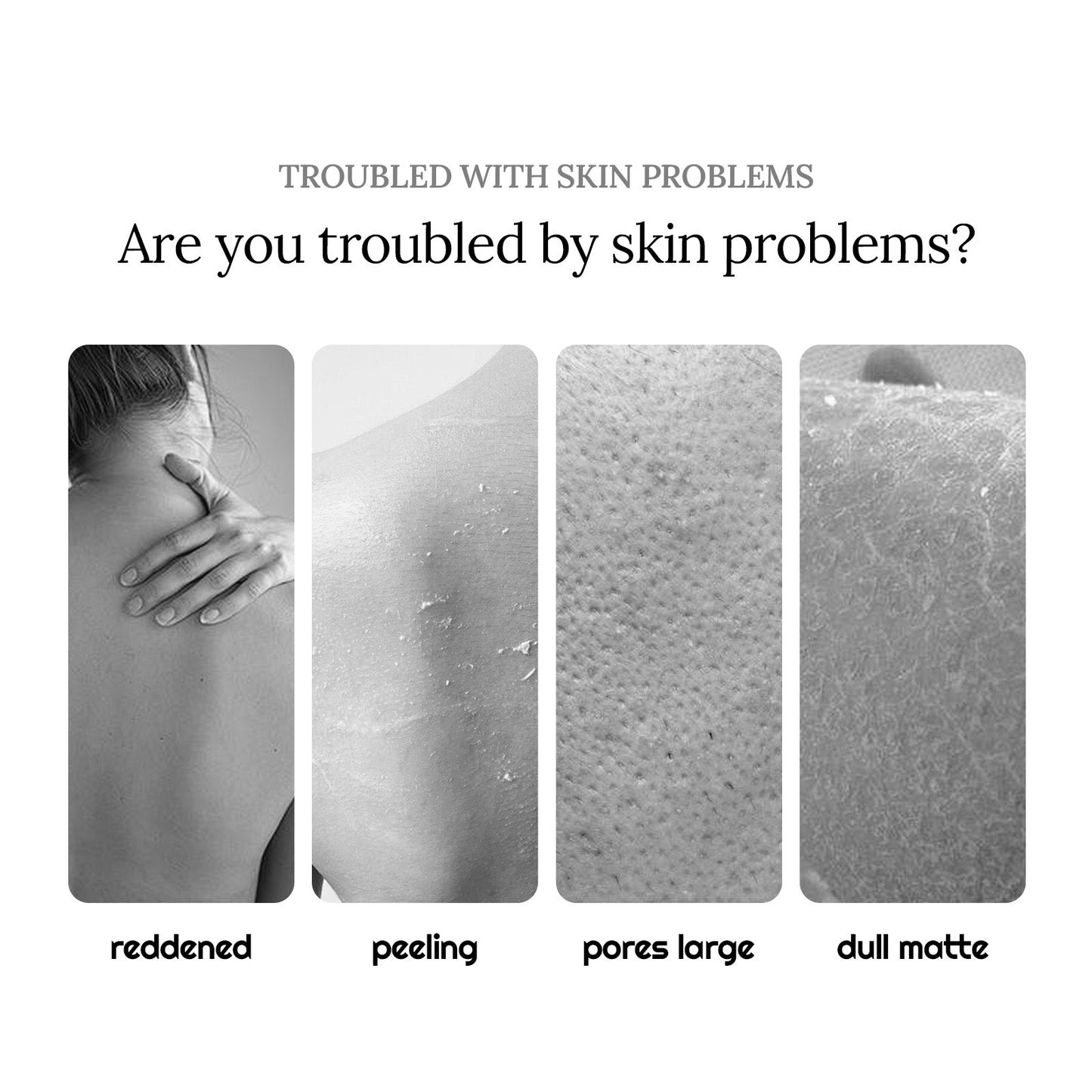 Propolis Shower Lotion, Body Skin Cleansing And Moisturizing Dull Exfoliating Body Wash - Korvel