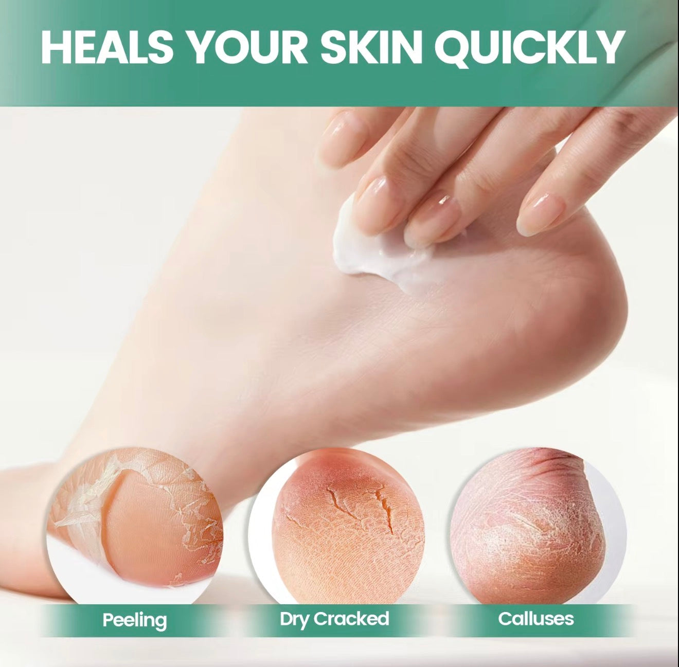 Crema Reparadora SkinCalm para Piel Sensible