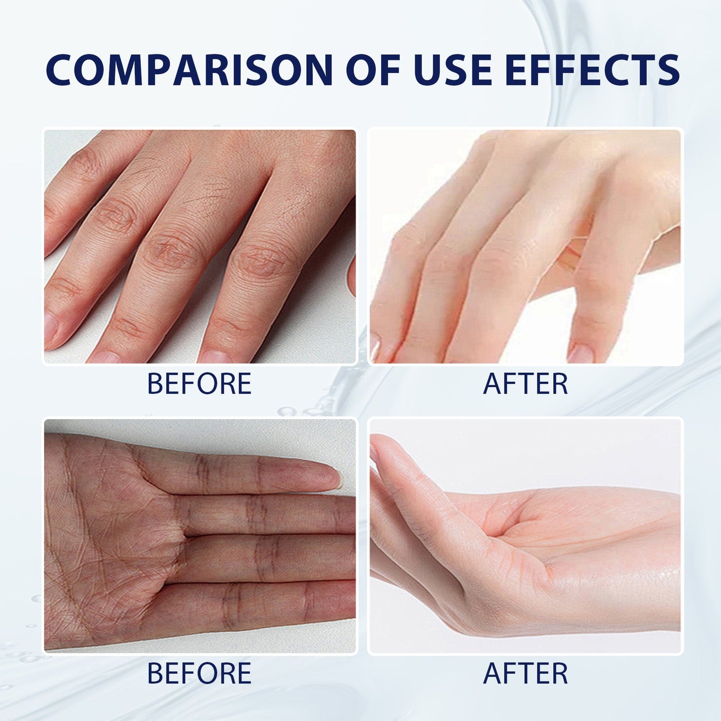 Aloe Vera Care Gel, Hydrating And Refreshing Moisturizing Cream Prevents Dryness And Cracks To Repair Hand Skin - Korvel
