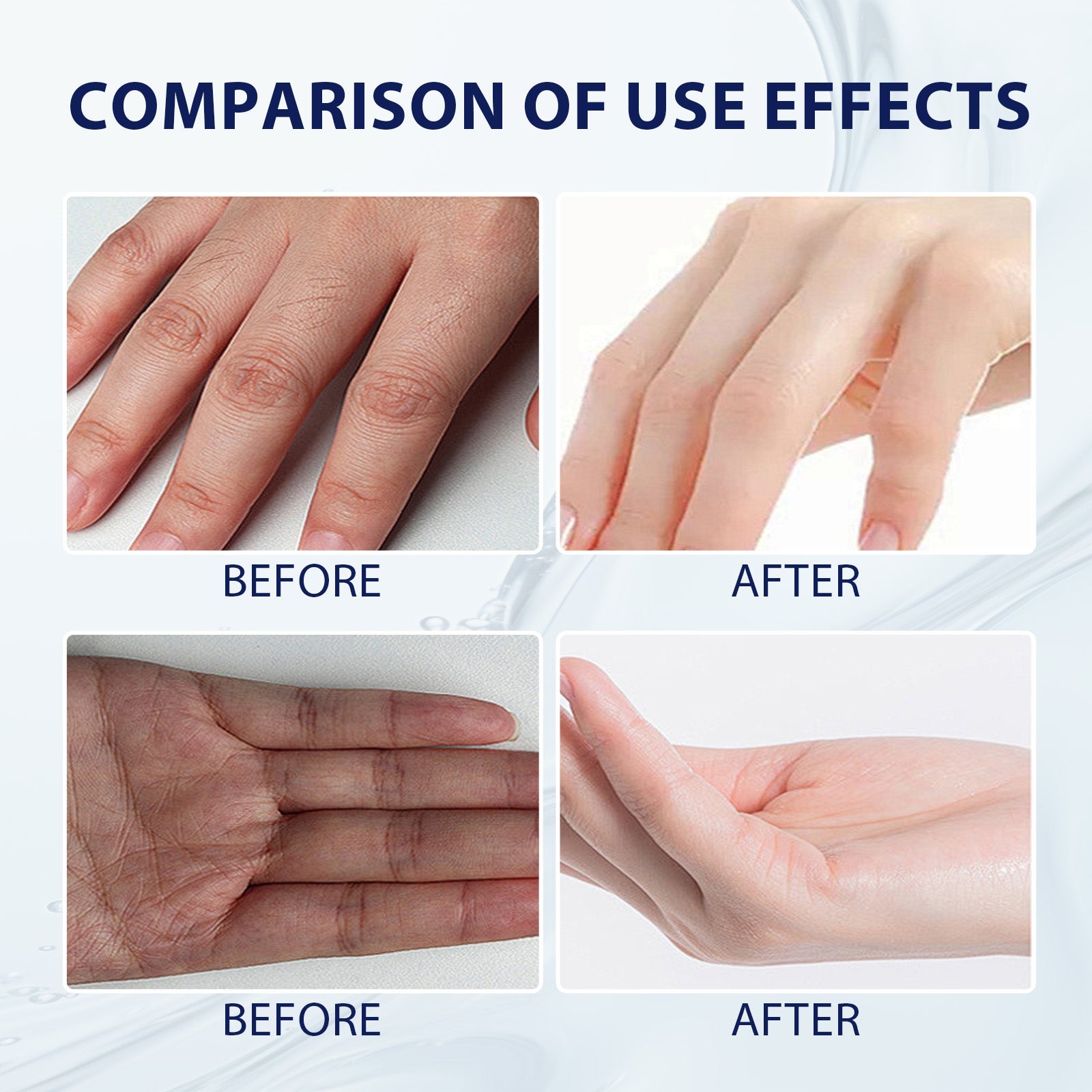 Aloe Vera Care Gel, Hydrating And Refreshing Moisturizing Cream Prevents Dryness And Cracks To Repair Hand Skin - Korvel