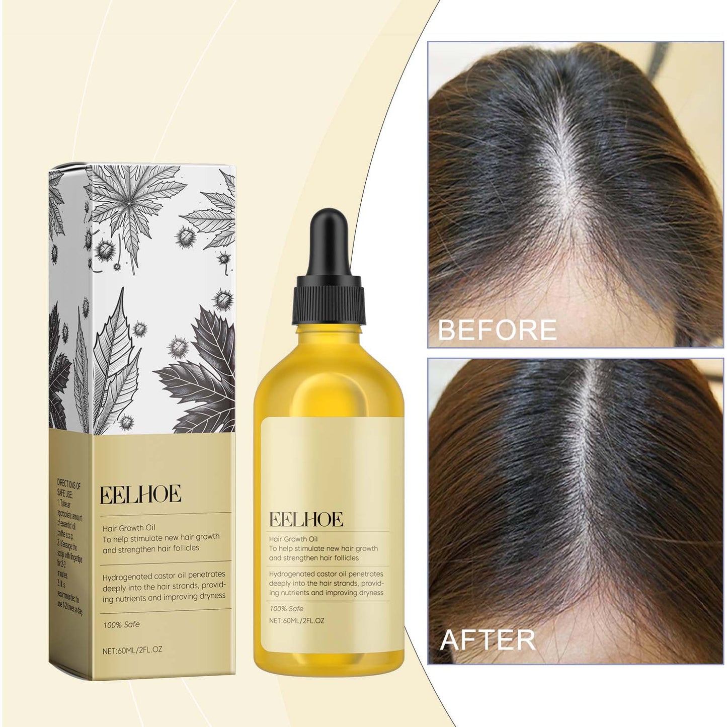 Castor Dense Hair Essential Oil Repair Dry And Damaged Scalp Hair Moist, Hydrating And Smoothing Hair - Korvel