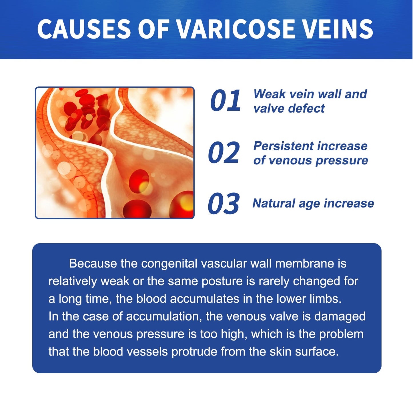 Premium Vein Massage Cream for Enhanced Leg Comfort