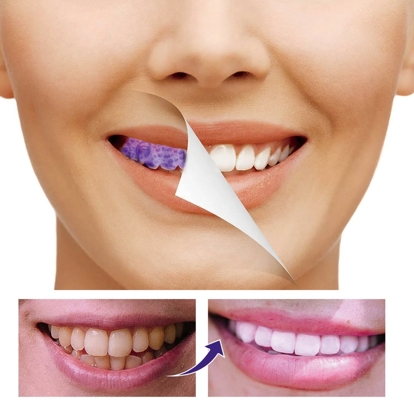 Premium Teeth Whitening Mousse for Fresh Breath