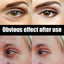 Astaxanthin Caviar Eye Cream, Moisturizing Skin Care Firming Fade Lines Eye Cream - Korvel