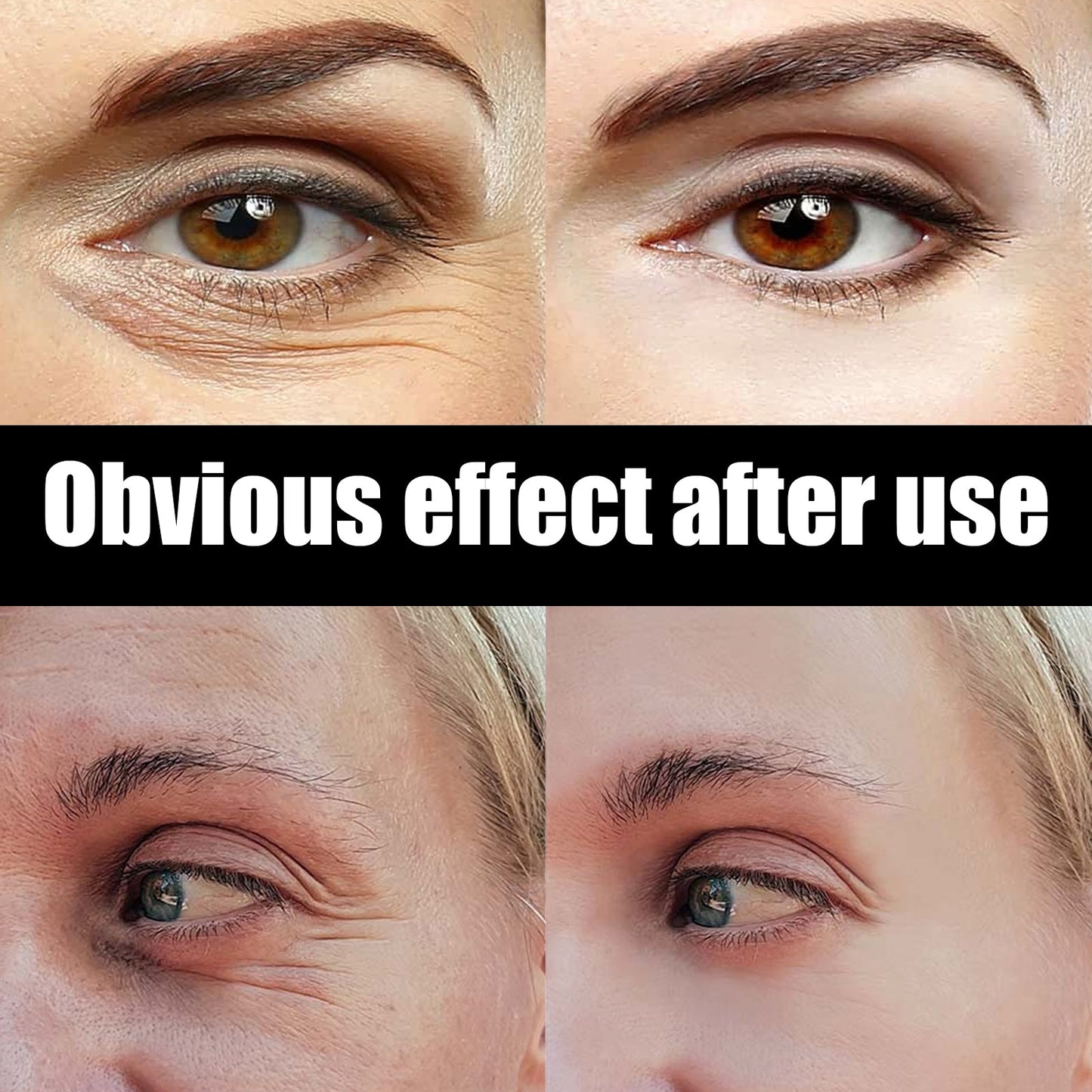 Astaxanthin Caviar Eye Cream, Moisturizing Skin Care Firming Fade Lines Eye Cream - Korvel