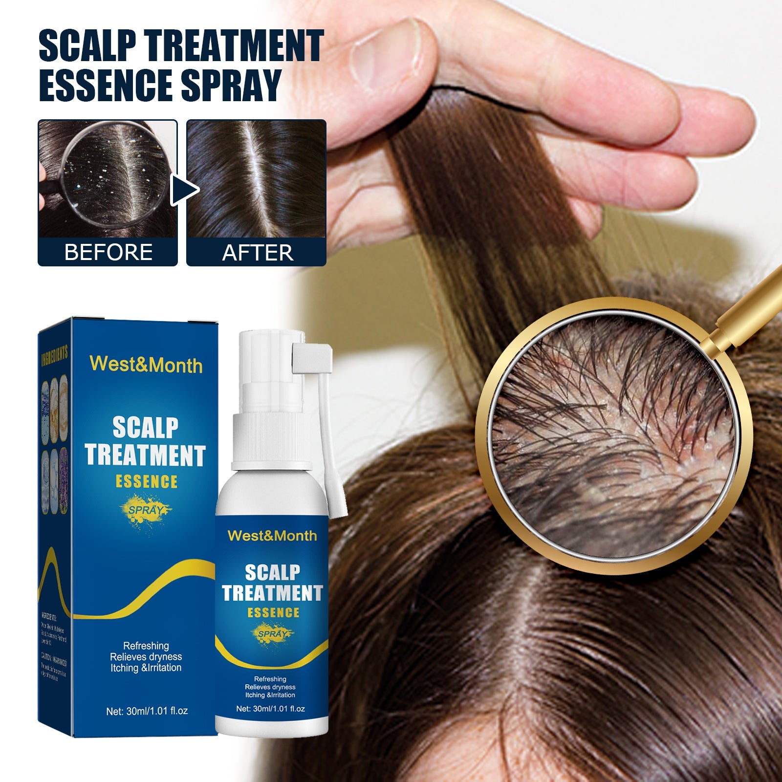 Scalp Treatment Essence Spray, Hair Care And Repair Damaged Hair Follicle Hair Root Treatment Spray - Korvel