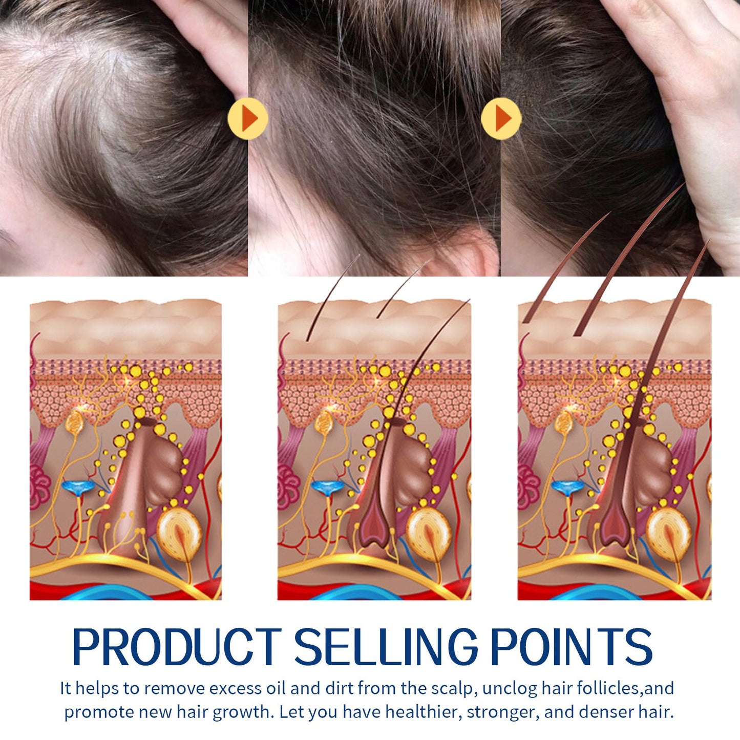 Hair Scrub Cleans Scalp Dandruff, Soothes Itchiness, Moisturizes Dense, Firming, And Prevents Hair Loss - Korvel