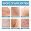 Scar Repair Serum Lightens Post-Pregnancy Scar Repair And Smoothes Body Skin - Korvel