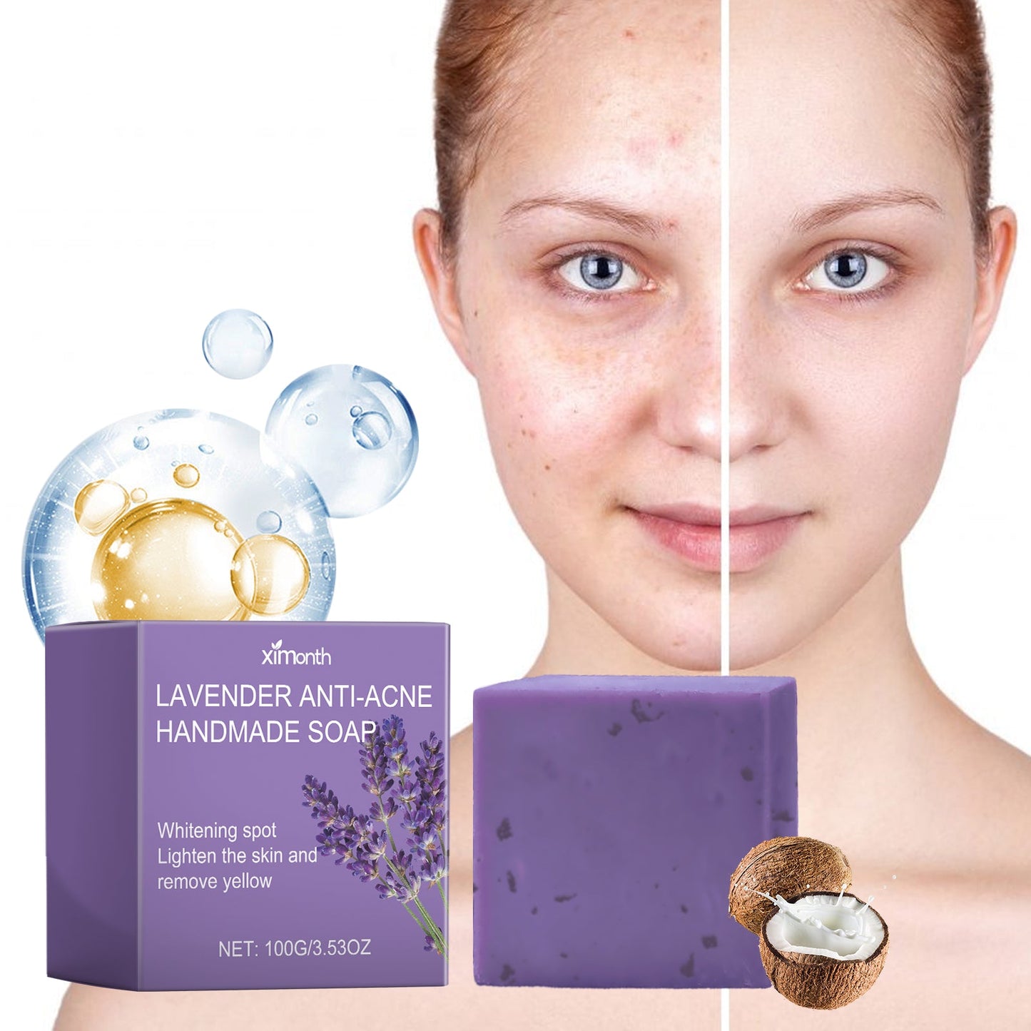 Lavender Oil Control Acne-Cleansing Soap For Cleansing Facial Skin Pores Oil Control Acne-Moisturizing Cleansing Soap - Korvel