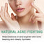 Green Tea Moisturizing Toner, Skin Tender Shine Clean Blain Mark Clear Water Not Greasy Toner - Korvel