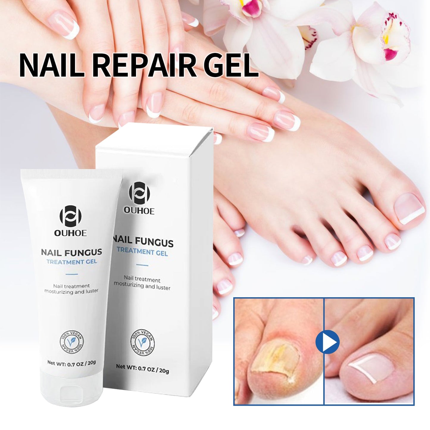 Nail Care Gel, Hand And Foot Gray Nails Soft Nail Shine Nail Thickening Nail Repair Gel - Korvel