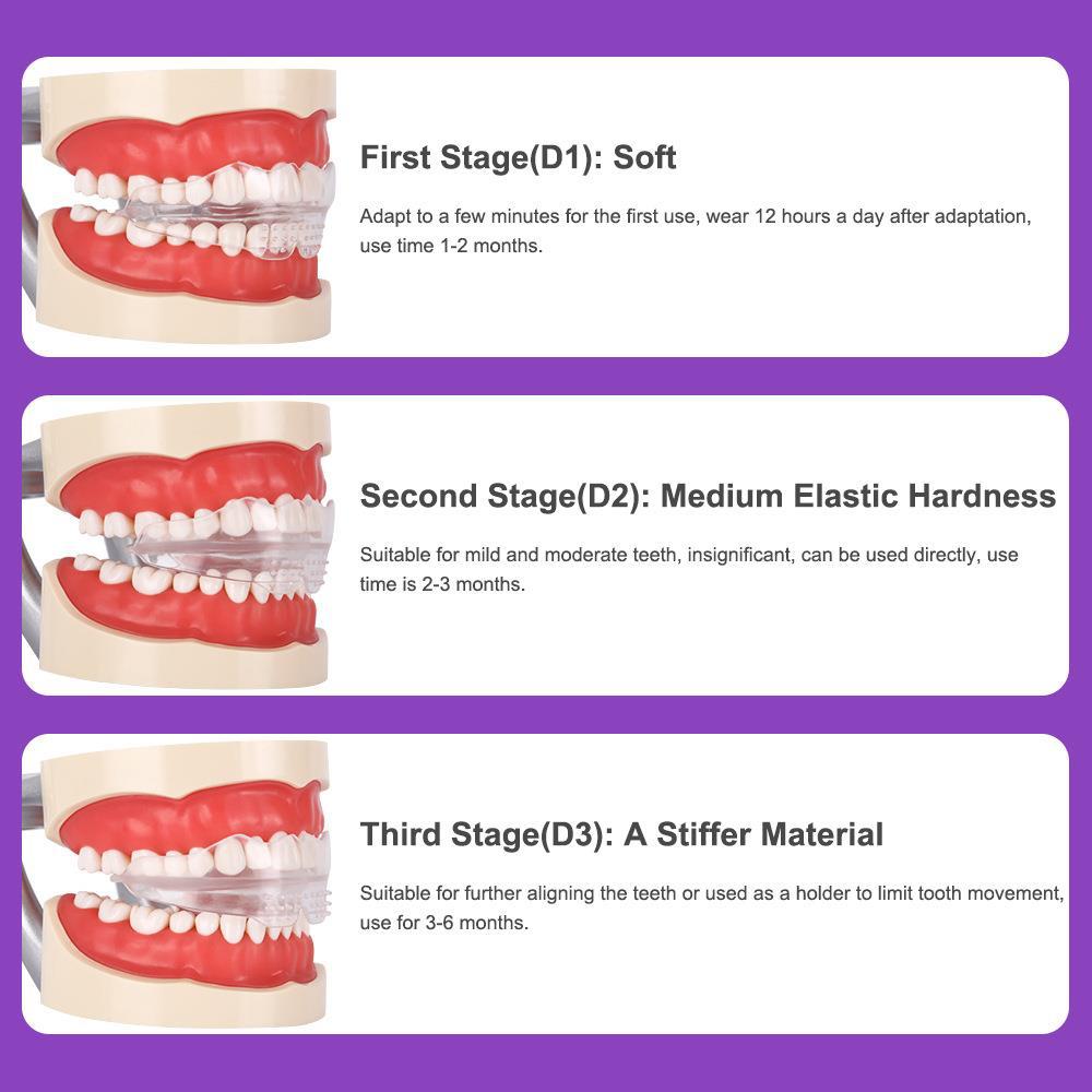 Transparent Orthodontic Braces for Adults