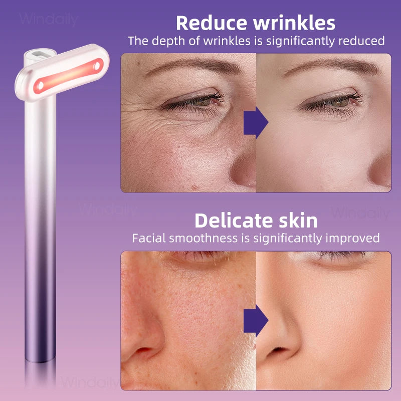 4 in 1 Facial Wand EMS Microcurrent Vibration Warm Red Light Face Lifting Machine Skin Tightening Device Neck Eye Massager Tools - Korvel