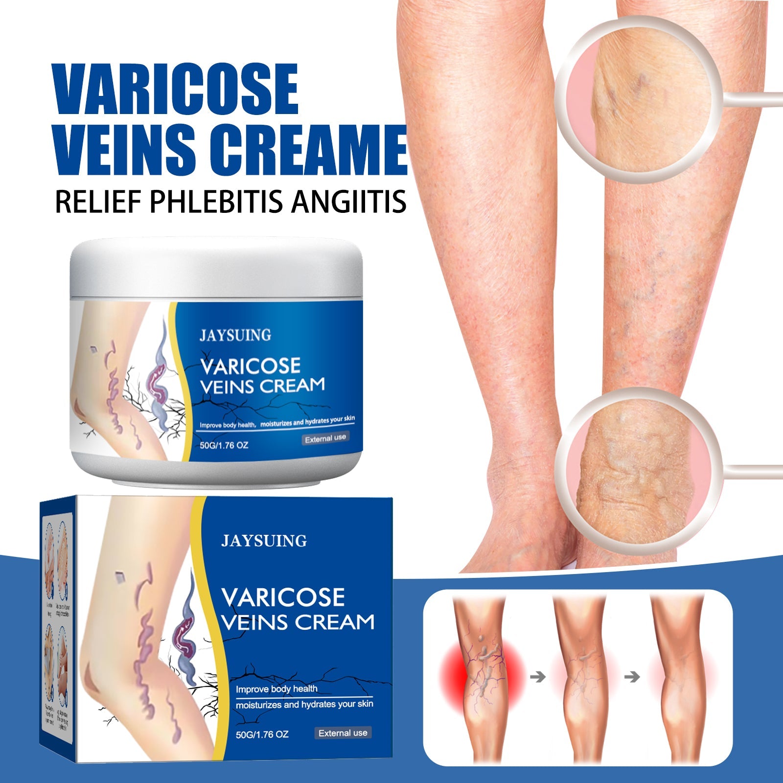 Leg Repair Cream Gently Massages Legs Soothing Body Care Leg Relief Topical Lotion - Korvel