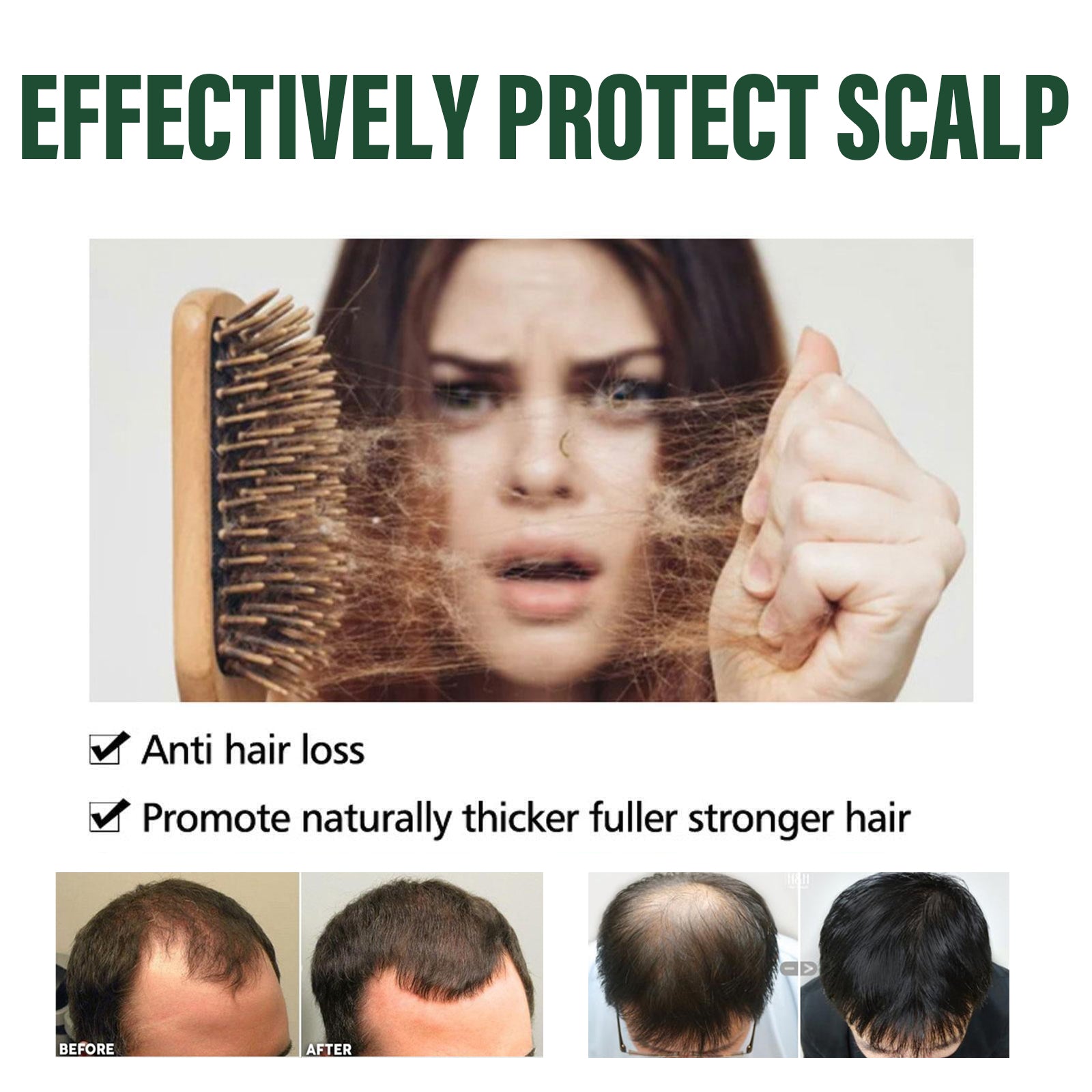Amla Anti Hair Thinning Shampoo, Scalp Cleanness Moist Smooth Shiny Hair, Dense Hair Wash Protect Suits - Korvel