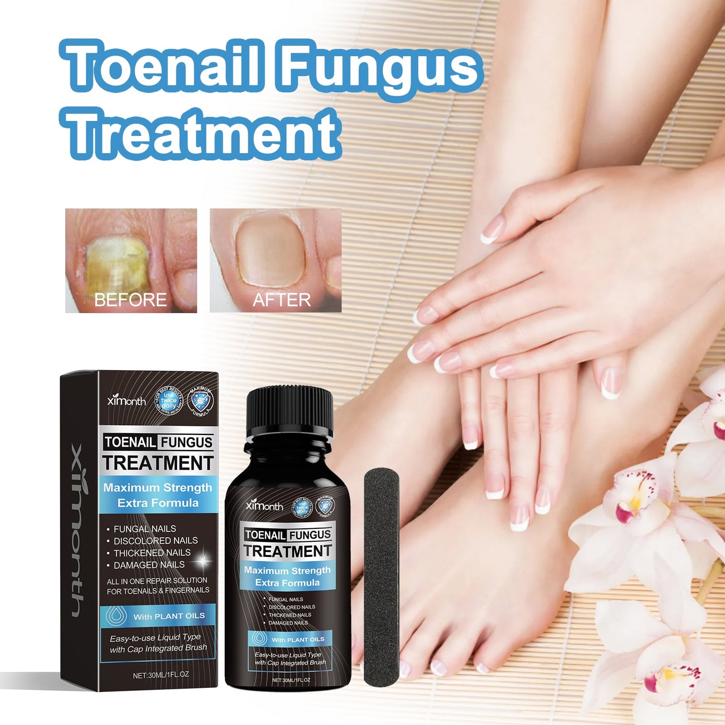 Toenail Fungus Treatment, Repair The Brotherhood Of Nails Rotten Jiasheng Mail This Soft Armour A Detailer - Korvel