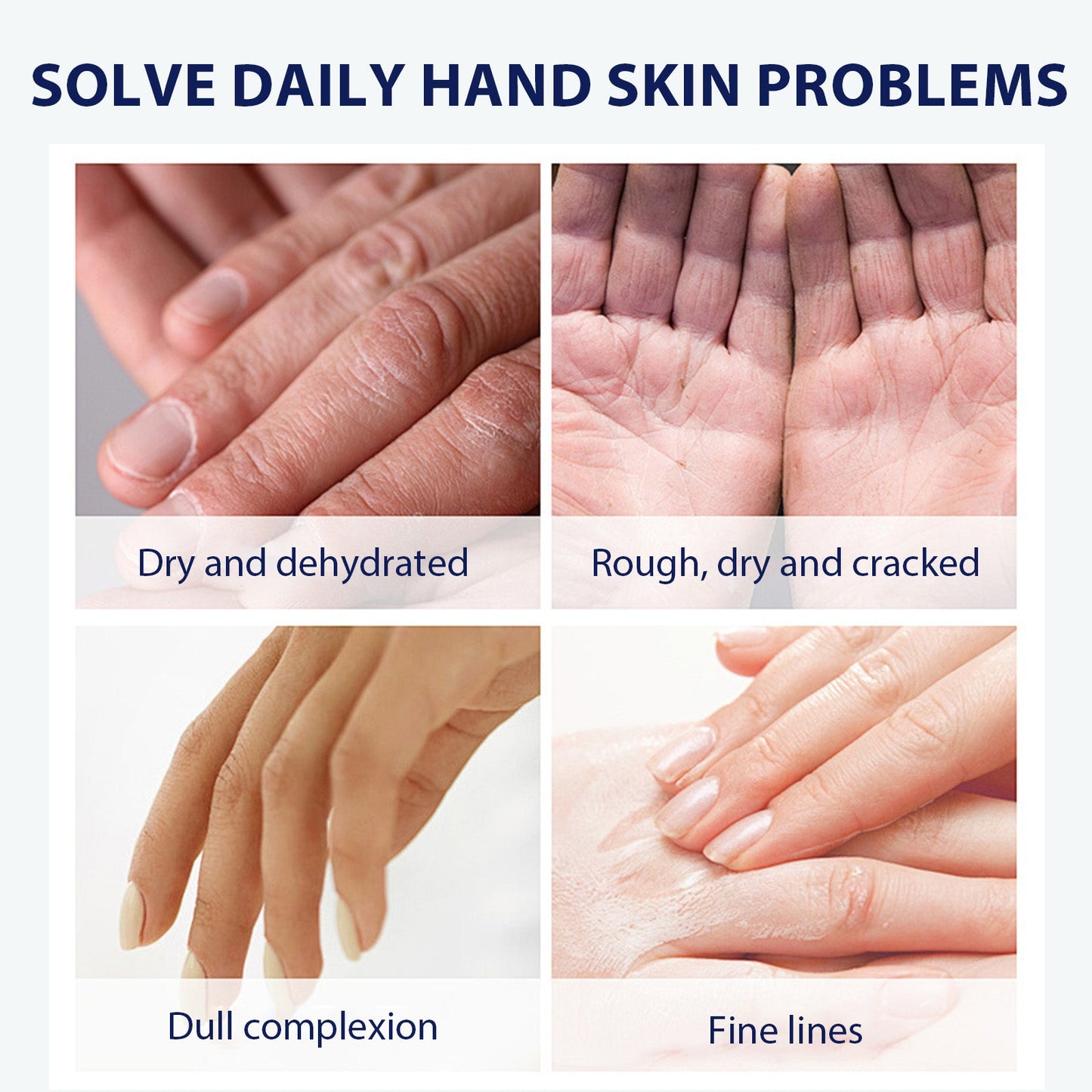 Aloe Vera Care Gel, Hydrating And Refreshing Moisturizing Cream Prevents Dryness And Cracks To Repair Hand Skin - Korvel