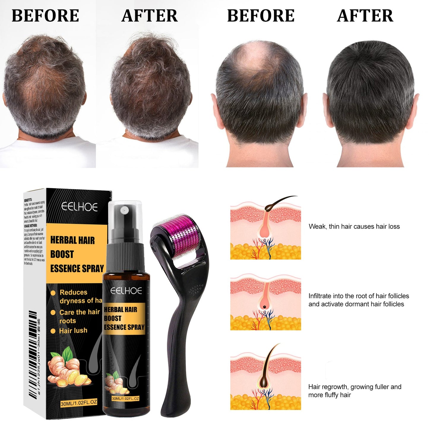 Herbal Hair Essence Spray,Prevent Falling Hair And Scalp Moisturizing And Nourishing Solution - Korvel