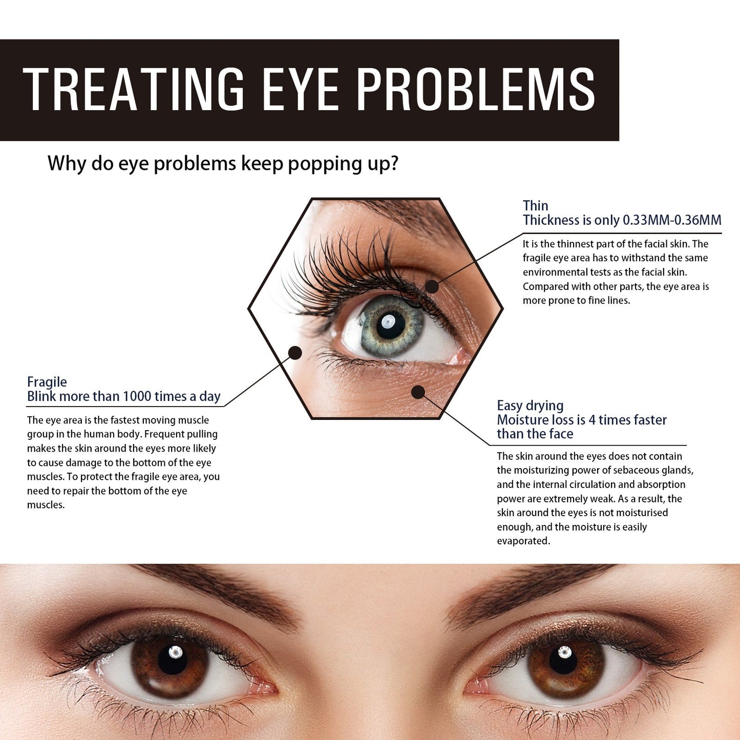 Retinol Eye Cream, Desalination Smoothen Fine Lines Eye Pouch Black Rim Of The Eye Moist Nursing Play Tight Muscle Eye Cream - Korvel