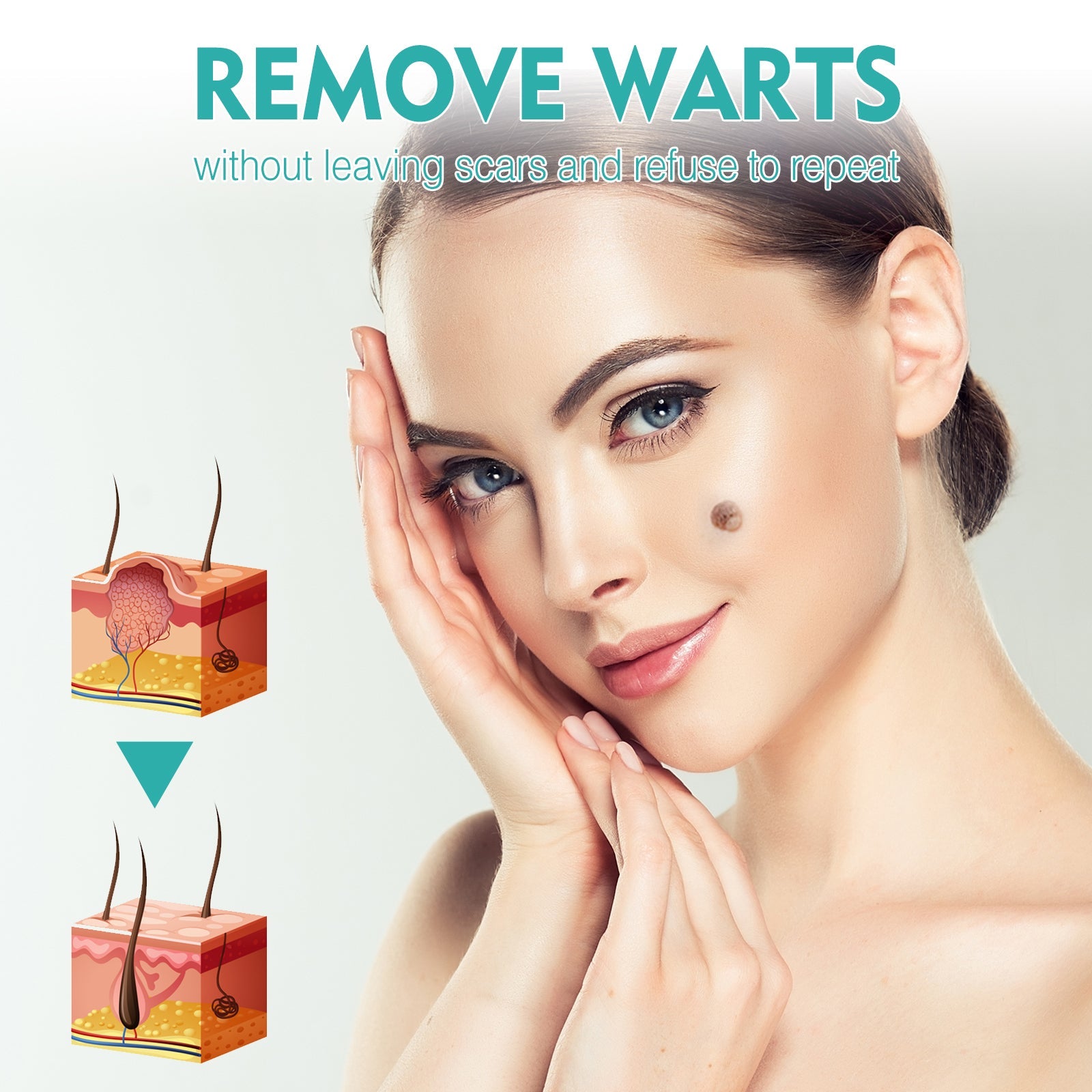 Gram Verruca Pen, Deep Cleaning Gram Verruca Remove Corns Meat Granules Repair Smooth Skin Anti-Verruca Liquid - Korvel