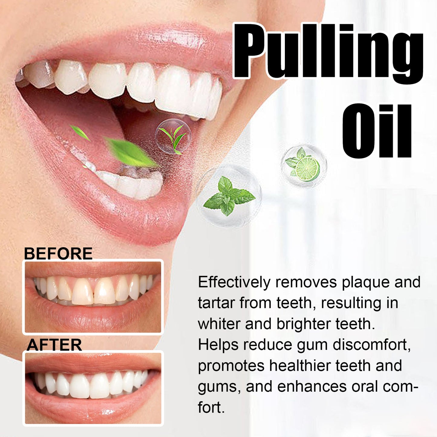Puling Oil, Clean Mouth Odor Tartar Very Well Protect Teeth And Fresh Breath - Korvel