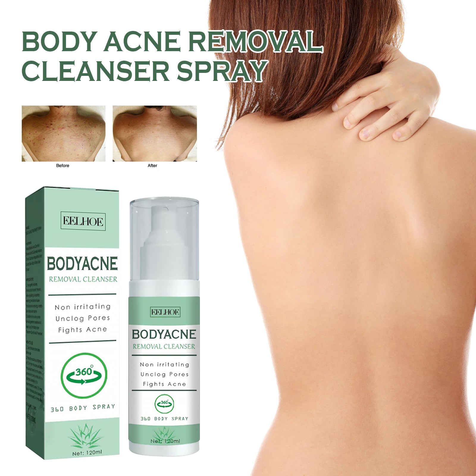Body Acne Removal Cleanser Spray, Deep Clean Back Arm Fade Acne Beauty Moisturizing Spray - Korvel